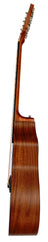 Chord Nomad Electro-Acoustic Guitar Koa - view 3